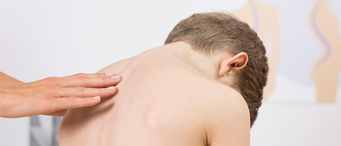 Chiropractic Care in Jacksonville For Scoliosis Relief Chiropractic Care in Jacksonville For Scoliosis Relief